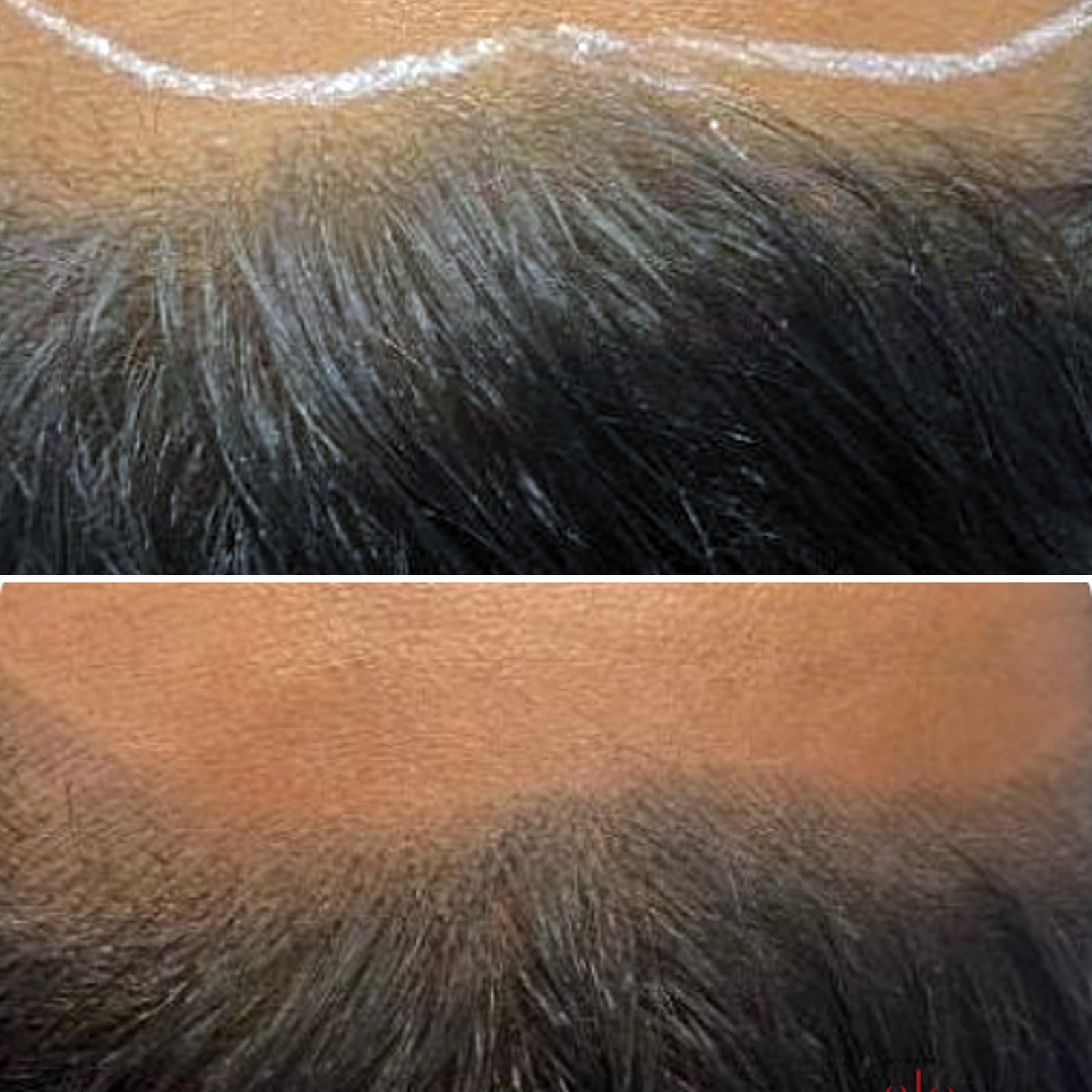 gro-hair-glo-skin-thanjavur