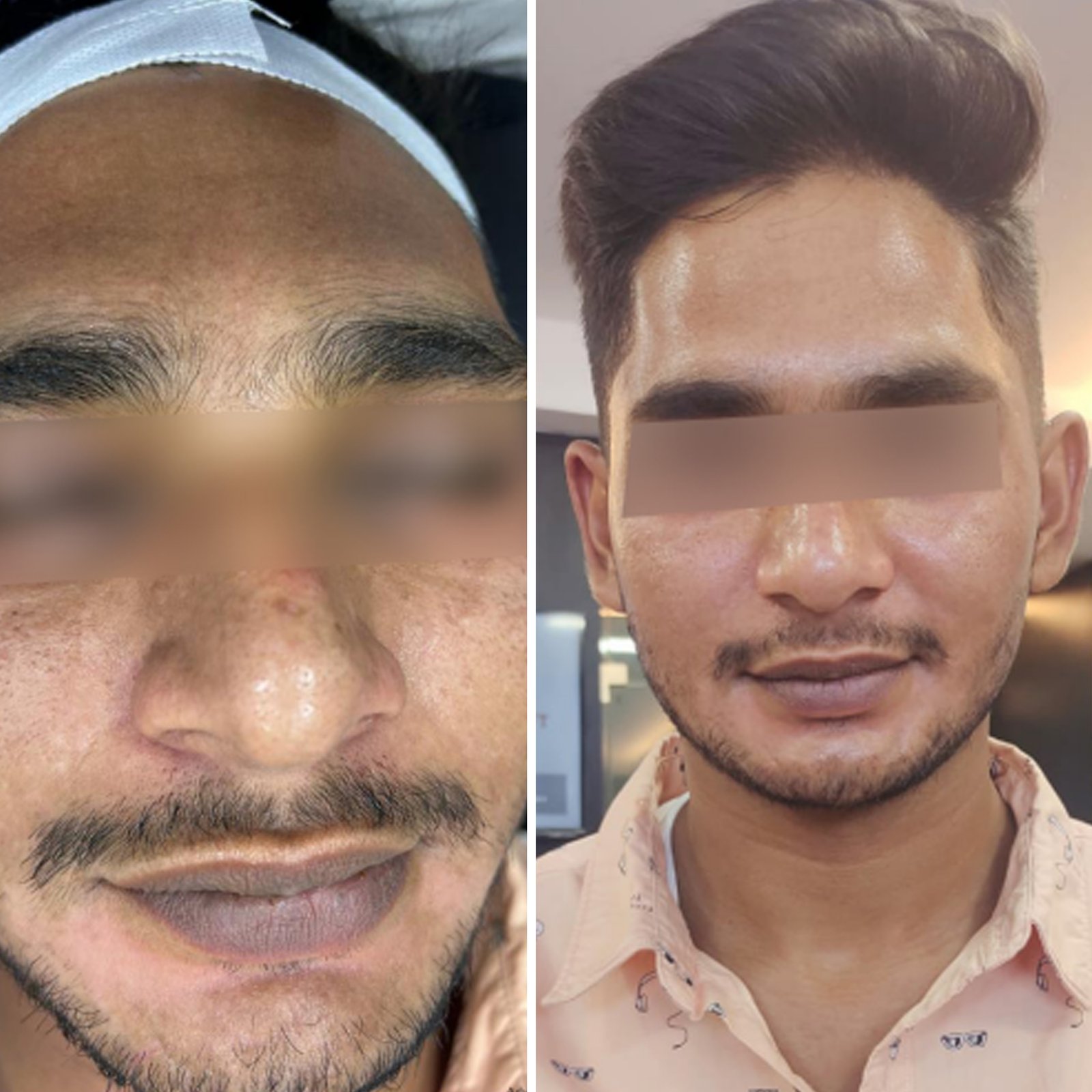 gro-hair-glo-skin-thanjavur