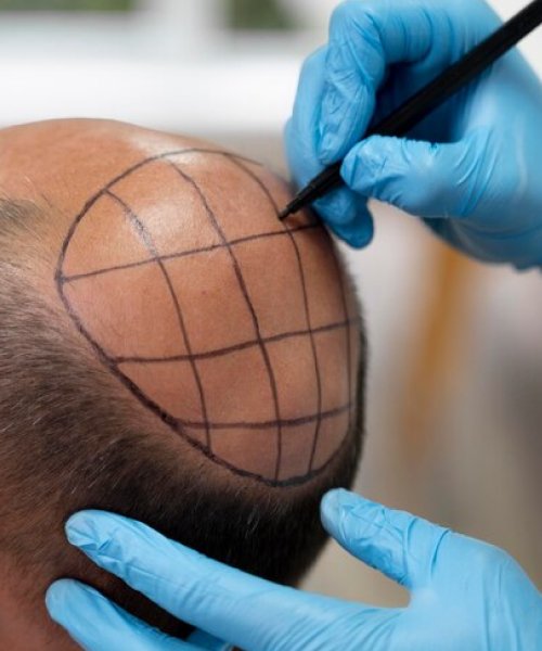 gro-hair-glo-skin-thanjavur