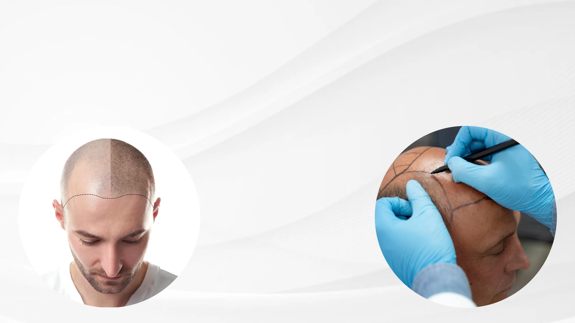 gro-hair-glo-skin-thanjavur